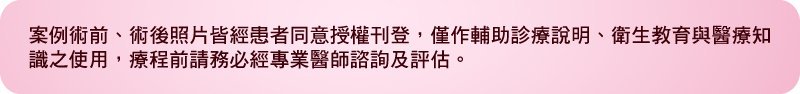 【面部拉提中心】對付肌膚彈性疲乏 光有拉提還不夠!還原肌膚新生的續航力 接回斷裂歲月痕跡+延續自體增生機能