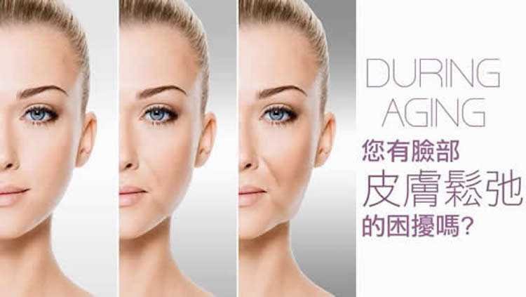 Quill8字,您有臉部皮膚鬆弛的困擾嗎?