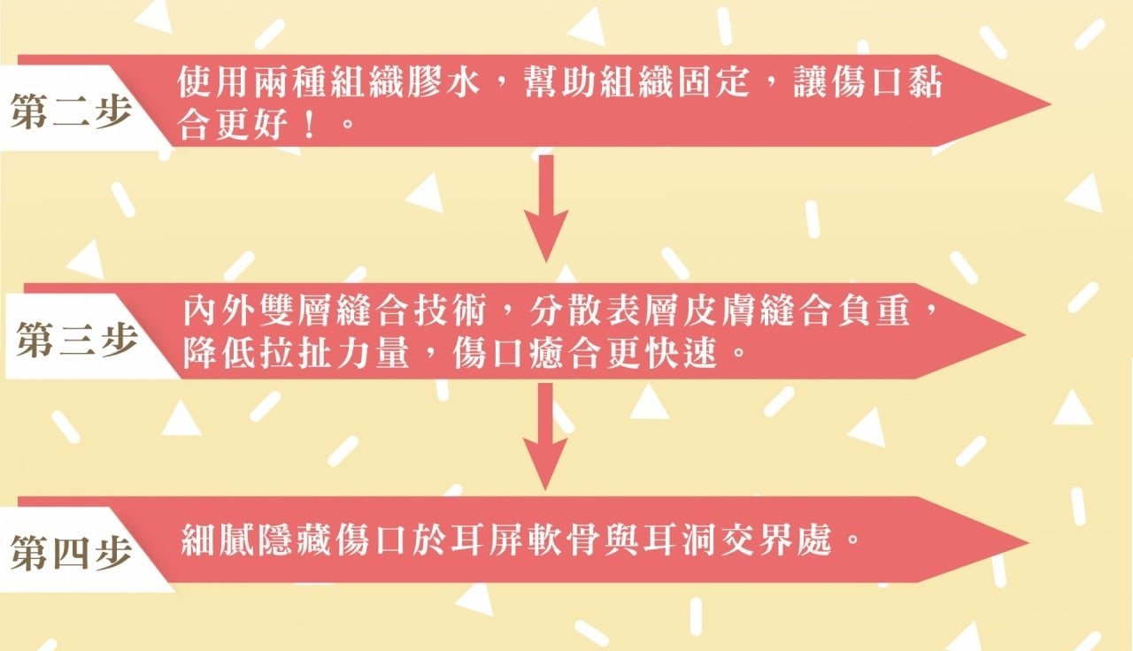 【三層次緊顏拉皮】拉皮全新進化版 由深至淺全面拉提收緊 姐的年紀、妹的外表!,使用兩種組織膠水,幫助組織固定,讓傷口黏合更好,第三部,內外雙層縫合技術,分散表層皮膚縫合負重,降低拉扯力量,傷口癒合更快速,第四步,細膩隱藏傷口於耳屏軟骨與耳洞交界處。
