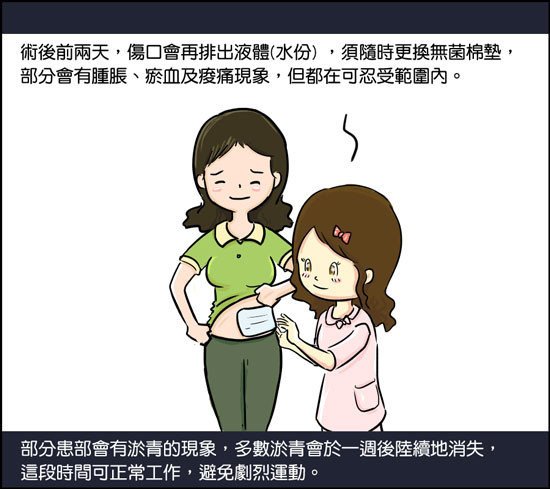 複合式抽脂精雕術,立新美學診所,部分患部會有瘀青的現象,多數瘀青會於一周後陸續消失,這段時間可正常工作,避免劇烈運動