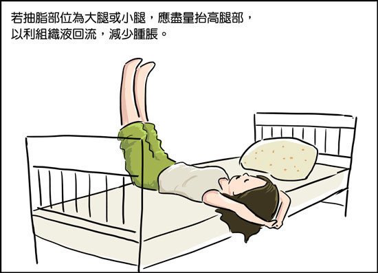 複合式抽脂精雕術,立新美學診所,若抽脂部位微大腿或小腿,應盡量抬高腿部,以利組織液回流,減少腫脹