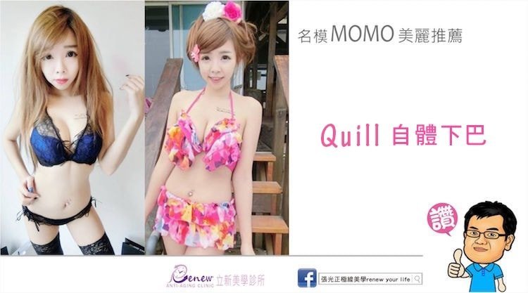Quill自體下巴,立新美學診所,名模MOMO美麗推薦