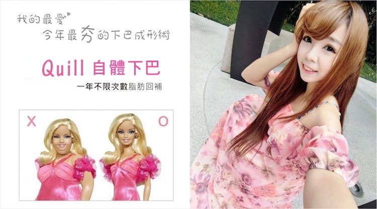 Quill自體下巴,立新美學診所,今年最夯的下巴成型術,Quill自體下巴一年不限次數脂肪回補