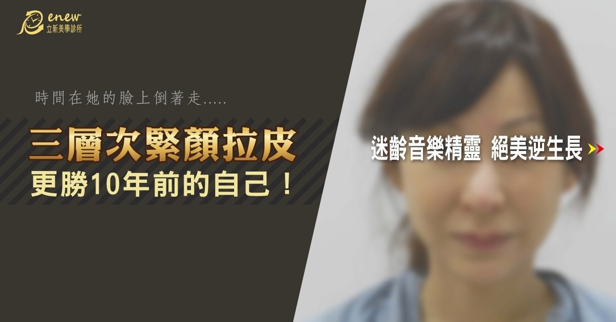 【三層次緊顏拉皮】拉皮全新進化版 由深至淺全面拉提收緊 姐的年紀、妹的外表!時間在他臉上倒著走,三層次緊言拉皮,更勝十年前的自己,迷齡音樂精靈,絕美逆生長
